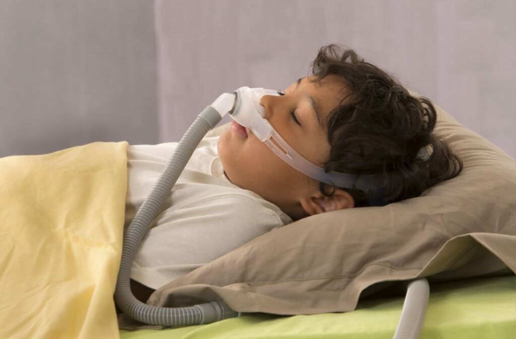 A child lies asleep on a bed, wearing a nasal CPAP mask connected to a grey tube, which helps support his breathing during sleep.
