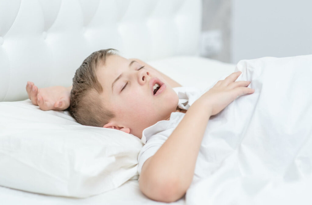 Child sleeping with mouth open, illustrating mouth breathing during sleep.